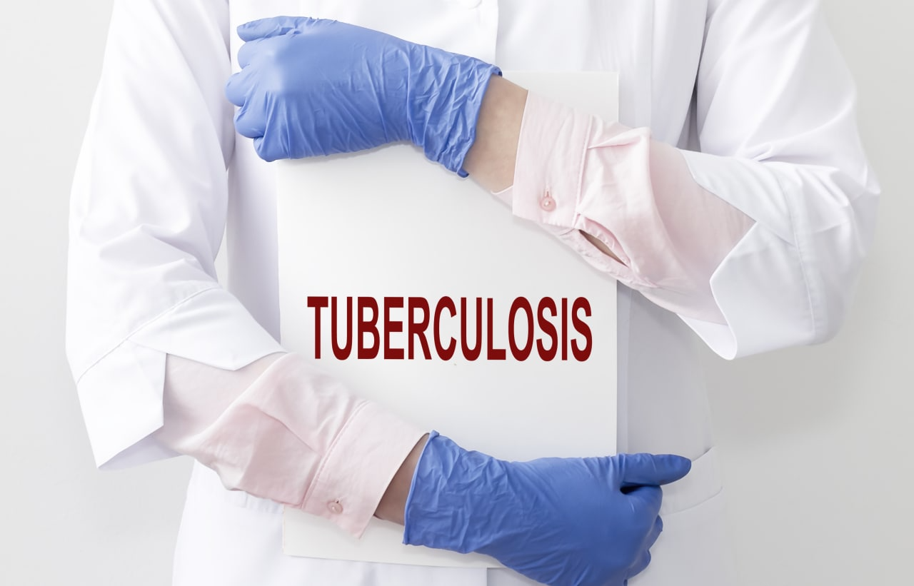  Oman Ministry of Health Launches National Tuberculosis Manual